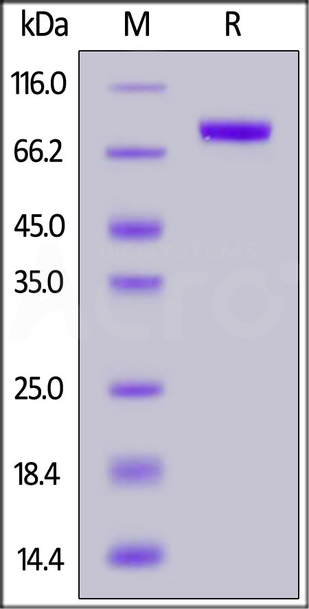 Human IL-3 R alpha, Fc Tag (Cat. No. ILA-H5252) SDS-PAGE gel