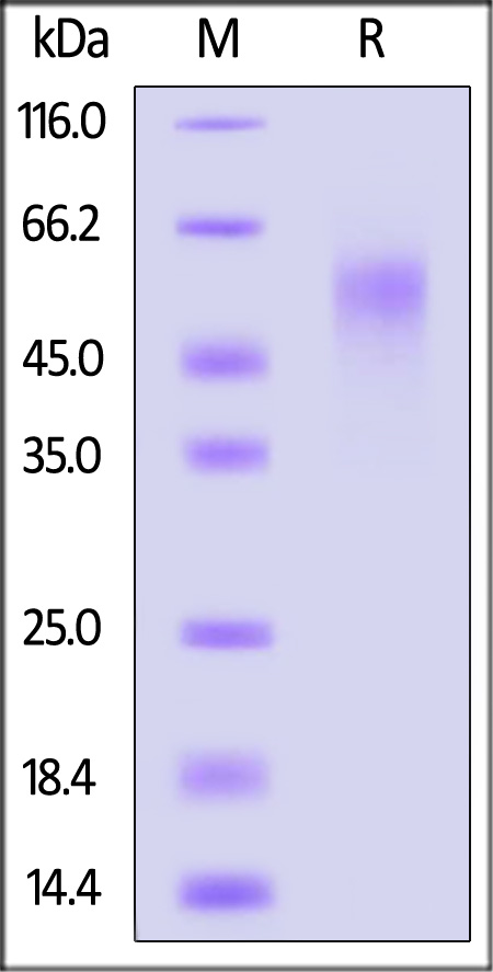 Cynomolgus IL-2 R gamma, His Tag (Cat. No. ILG-C52H9) SDS-PAGE gel