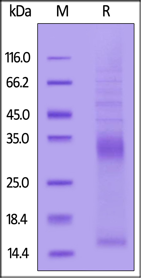 Human VEGF-B, His Tag (Cat. No. VE6-H5225) SDS-PAGE gel