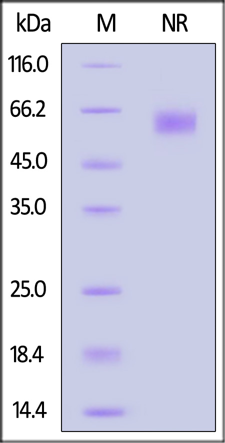 Rat OX40 Ligand, His Tag (Cat. No. OXL-R5248) SDS-PAGE gel