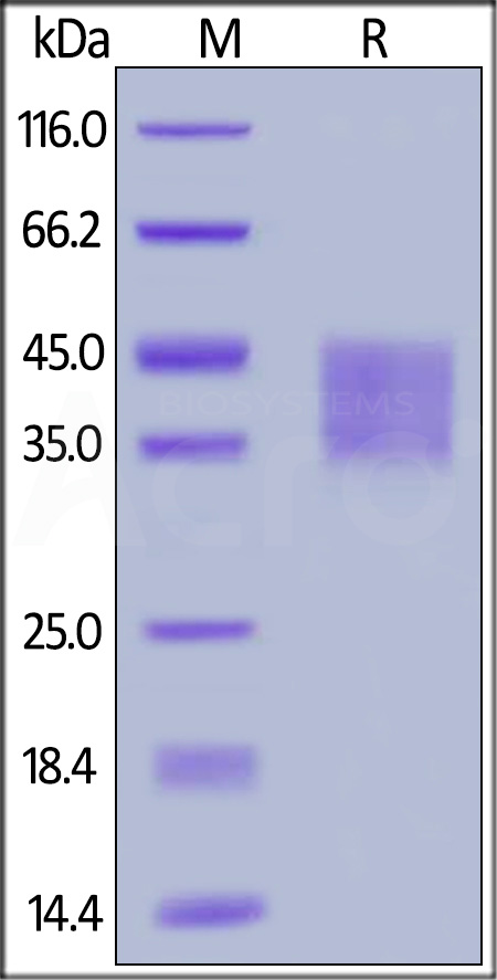 Human IFNAR2, His Tag (Cat. No. IF2-H5224) SDS-PAGE gel