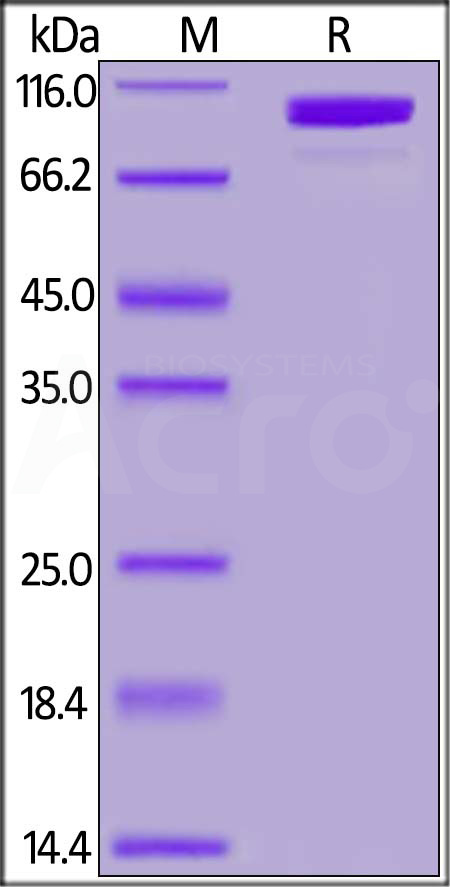 Human Complement C2, His Tag (Cat. No. CO2-H52H7) SDS-PAGE gel