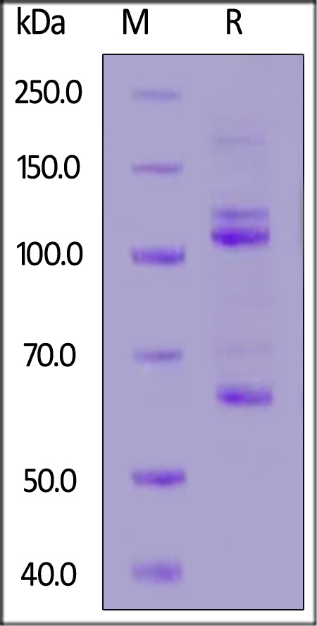 Mouse Complement C3, His Tag (Cat. No. CO3-M52H4) SDS-PAGE gel