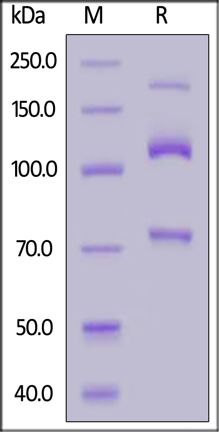 Human Complement C3, His Tag (Cat. No. CO3-H52H3) SDS-PAGE gel