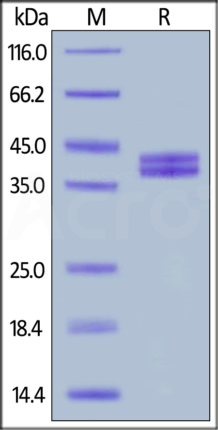 Human Complement C5a, Fc Tag (Cat. No. C5A-H525a) SDS-PAGE gel