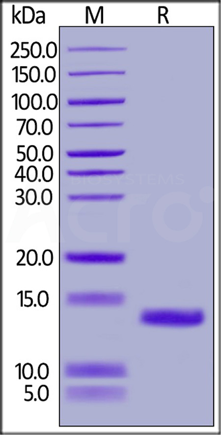 Mouse Complement C5a, His Tag (Cat. No. C5A-M51H4) SDS-PAGE gel