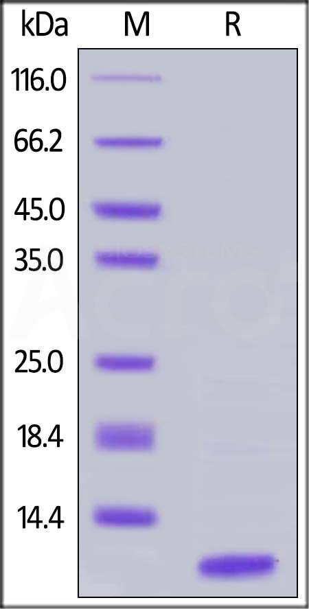 Human Complement C5a, Tag Free (Cat. No. C5A-H5116) SDS-PAGE gel