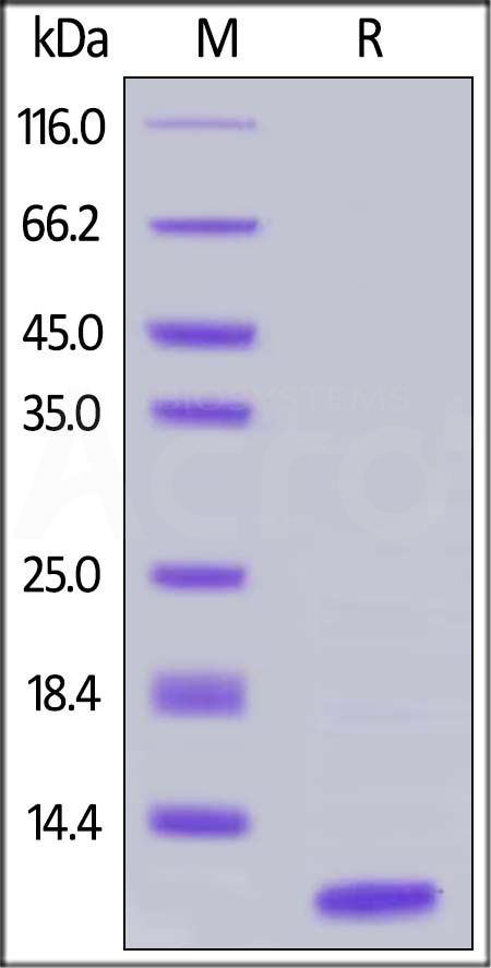 Human Complement C5a, Tag Free (Cat. No. C5A-H5116) SDS-PAGE gel